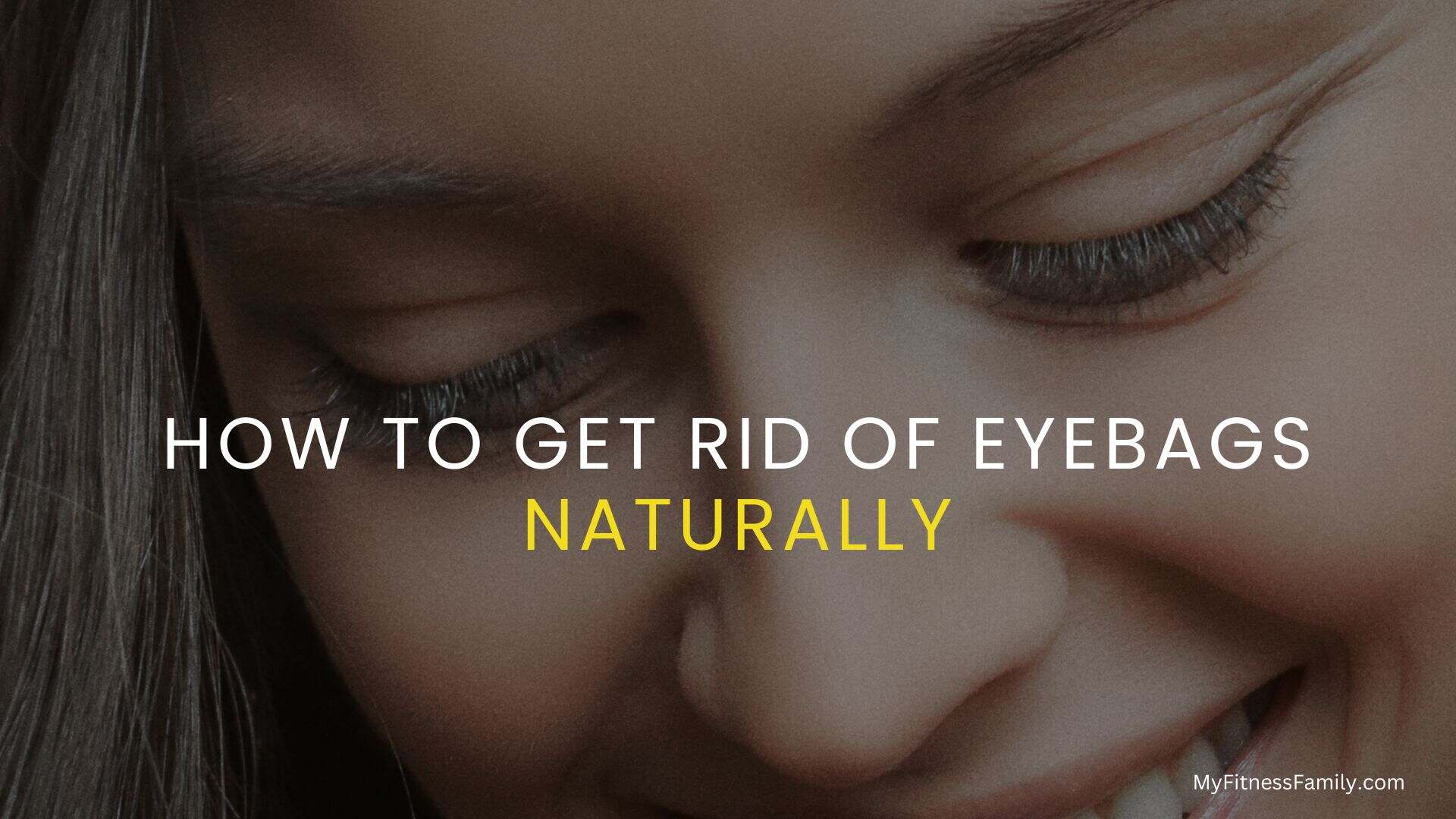 how to get rid of eyebags naturally